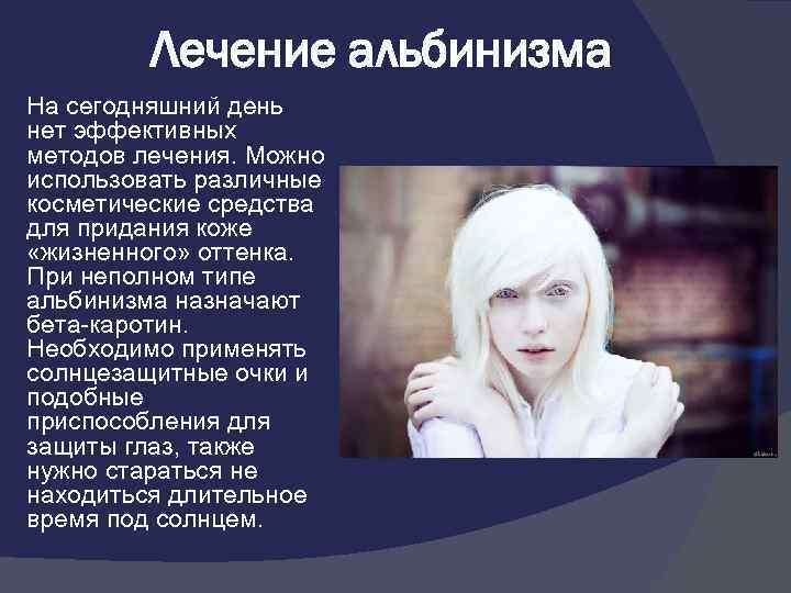 Альбинизм у человека