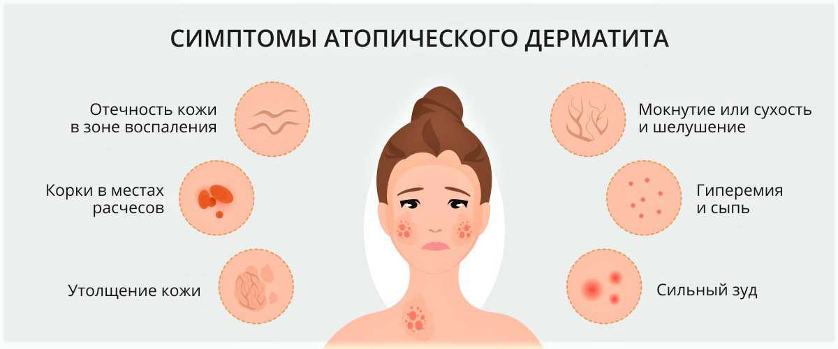 Кожный зуд у детей: причины, лечение, диагностика