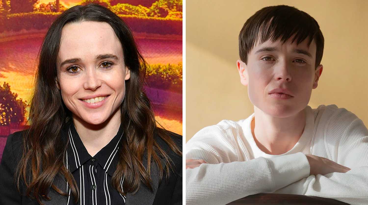 Операция по смене пола: фото до и после сменивших пол знаменитостей