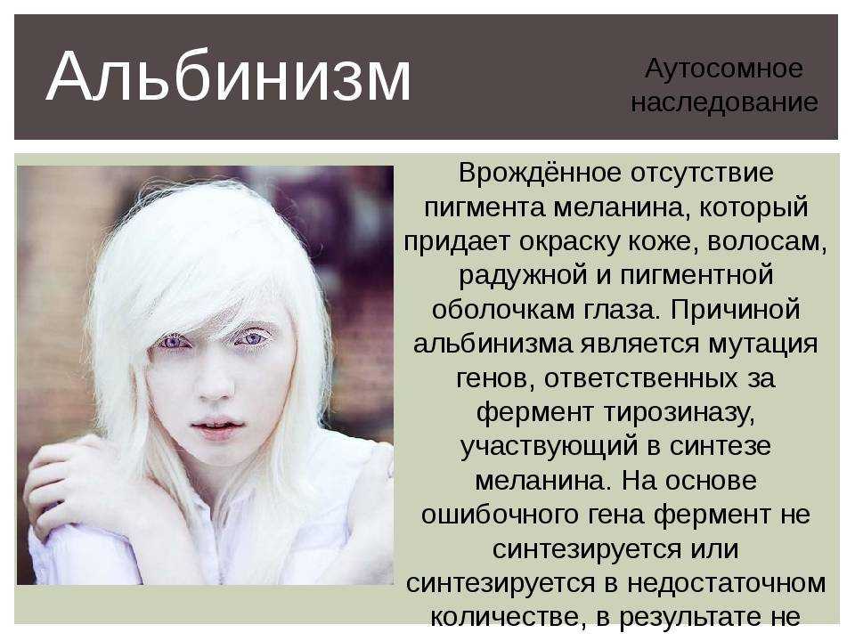 Альбинос: кто такой, 3 типа альбинизма, способы лечения, советы, видео