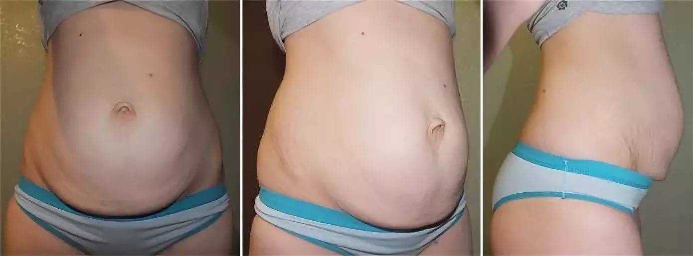 Как похудеть после родов: диета, нюансы и тонкости питания и упражнений для похудения после рождения ребенка