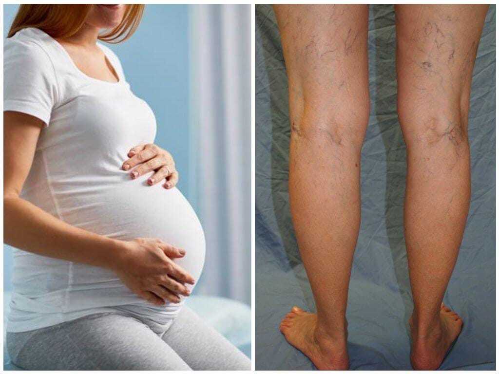 Как быстро восстановиться после родов и вернуть дородовую форму