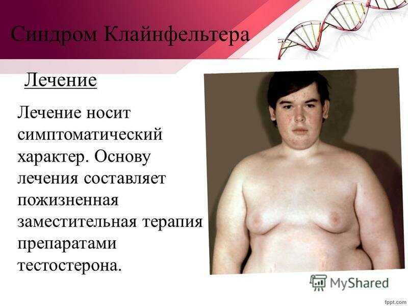 Синдром питера пэна или почему не хочется взрослеть?