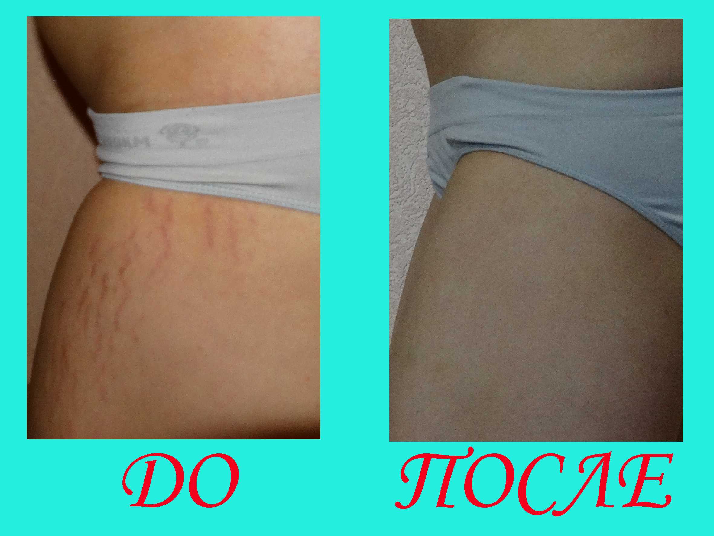 10 эстетических последствий беременности и способы с ними справиться. красота. эстетический гид.