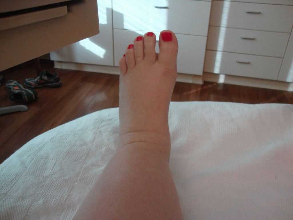 Восстановление после родов: с чего начать, как быстро откорректировать фигуру в домашних условиях?