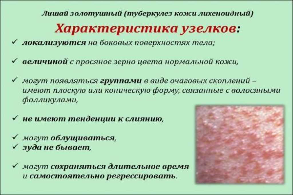 Постоянный зуд: что делать, если ребенок расчесывает тело, симптомы, как помочь