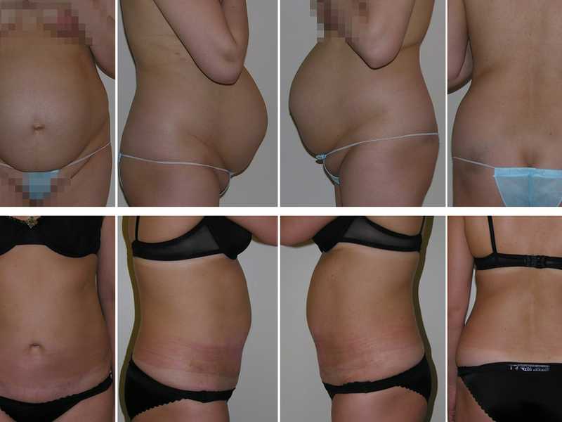 ✅ почему нога увеличила размер после беременности. ждать ли увеличения размера ступни после родов. изменения во всём - wokak.ru