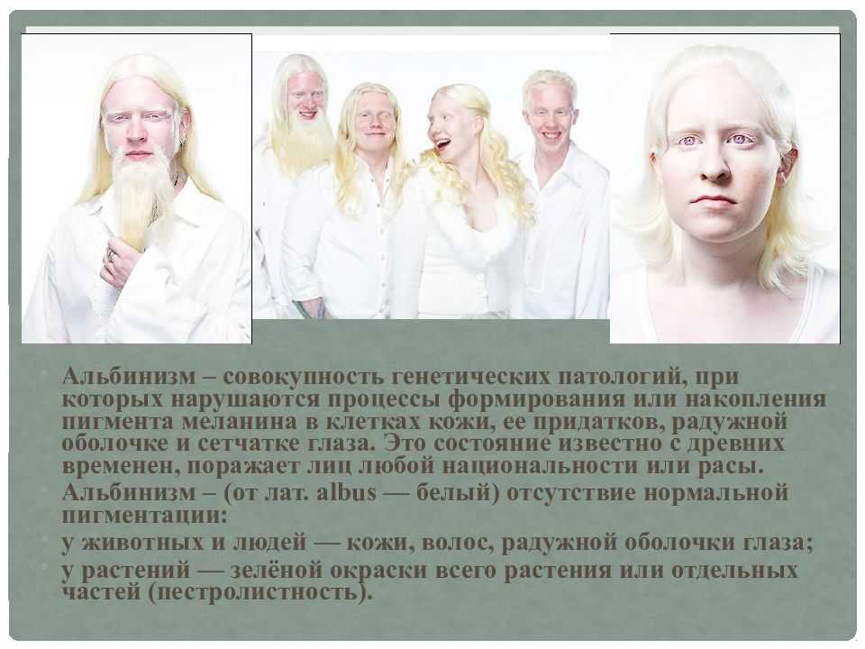 Люди альбиносы - интересные факты и фото > интересные факты