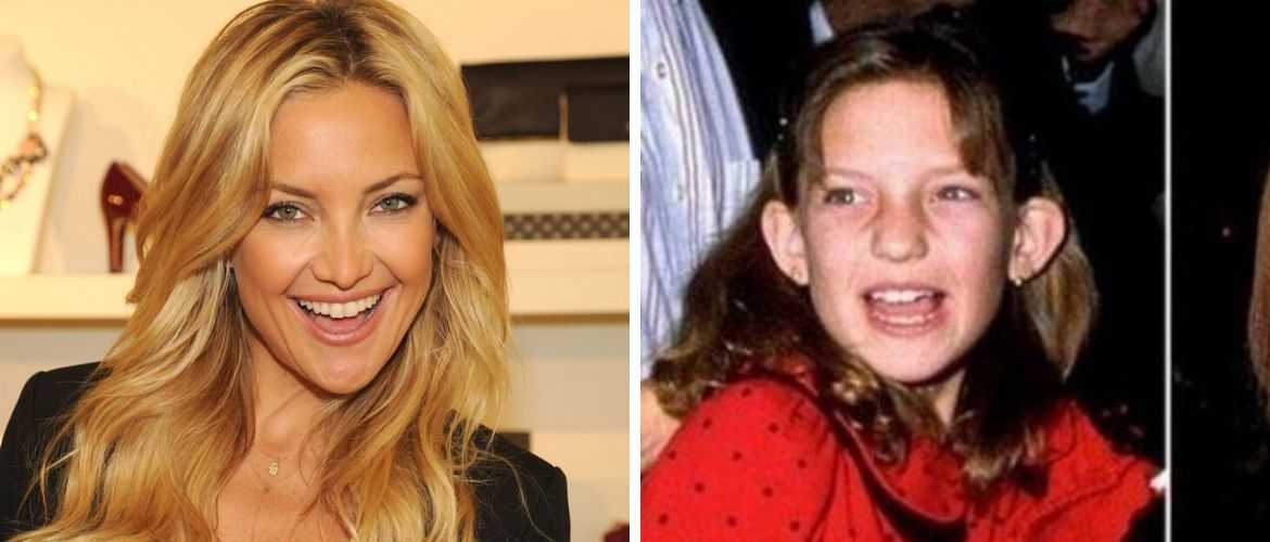 Знаменитости, которые в детстве комплексовали из-за своей внешности / mama66.ru