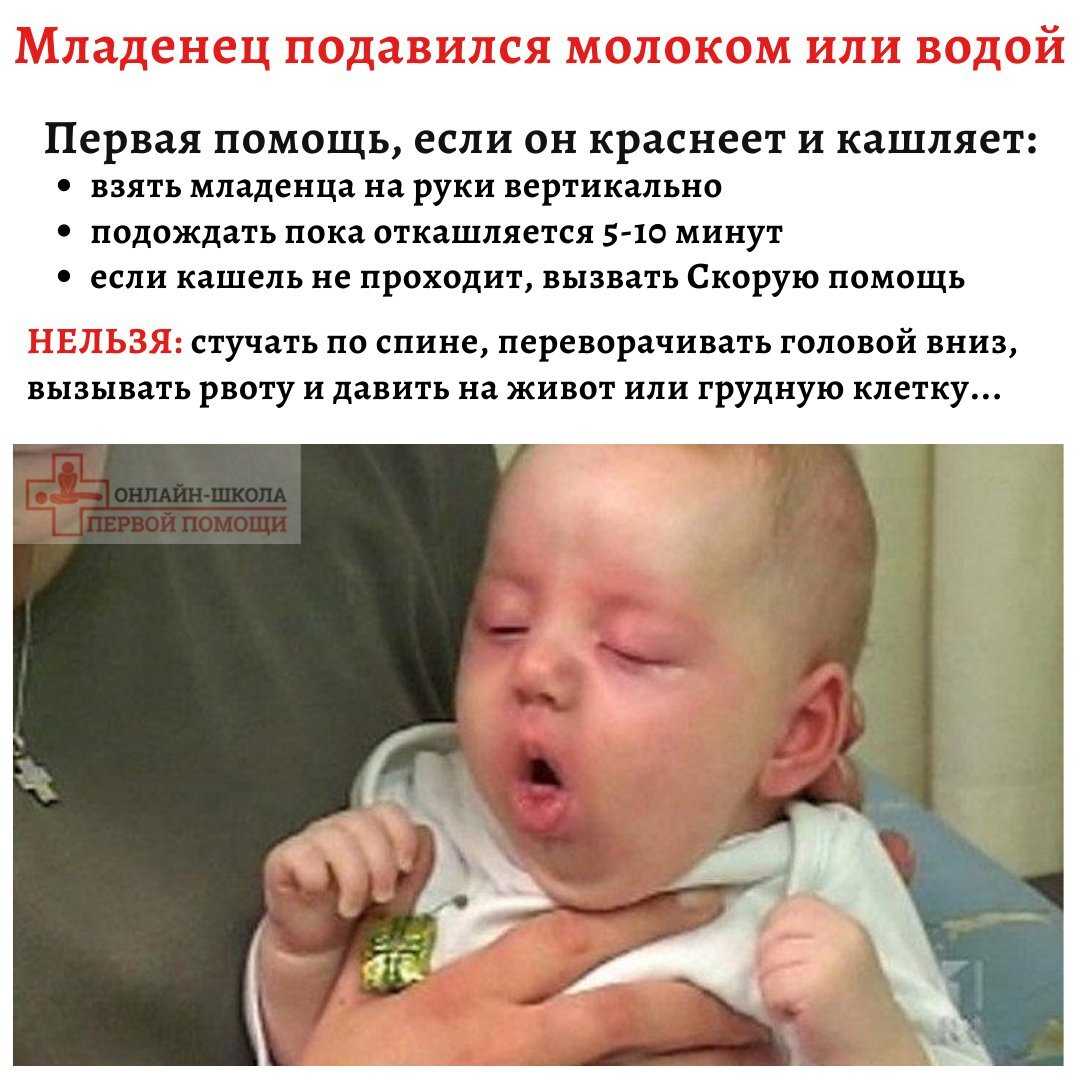 Что делать, если ребенок подавился - мамсила
