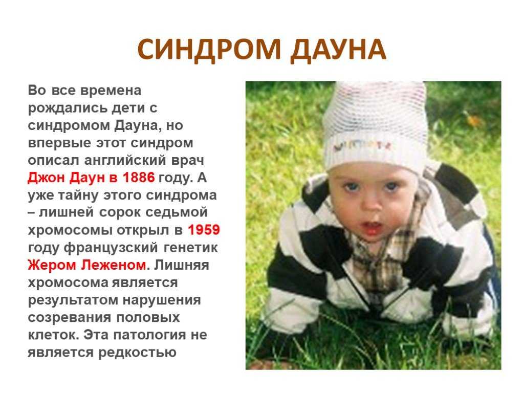Международный день человека с синдромом дауна 