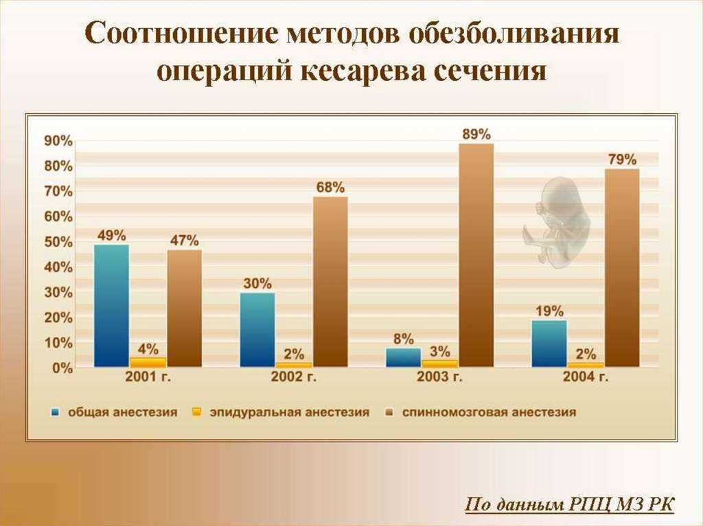 Cколько раз можно делать кесарево сечение?