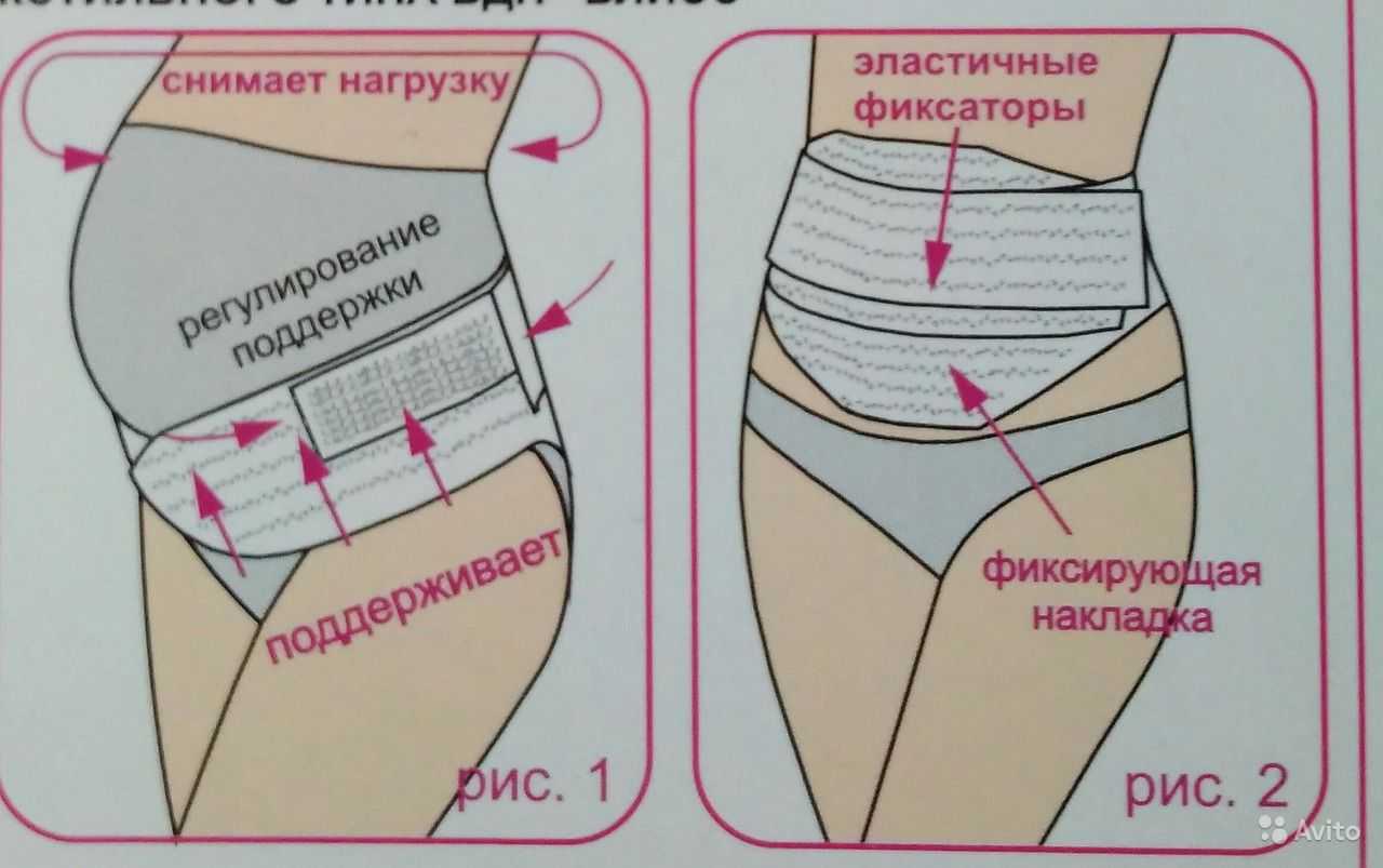 Послеродовой бандаж: как правильно одевать, сколько носить и как выбрать лучший утягивающий корсет или пояс