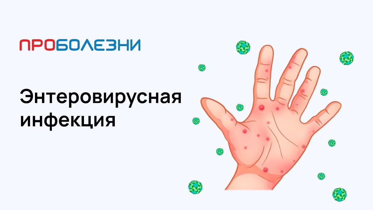 Вирус из турции симптомы. страсти по коксаки. опасен ли «турецкий» вирус? | здоровье человека