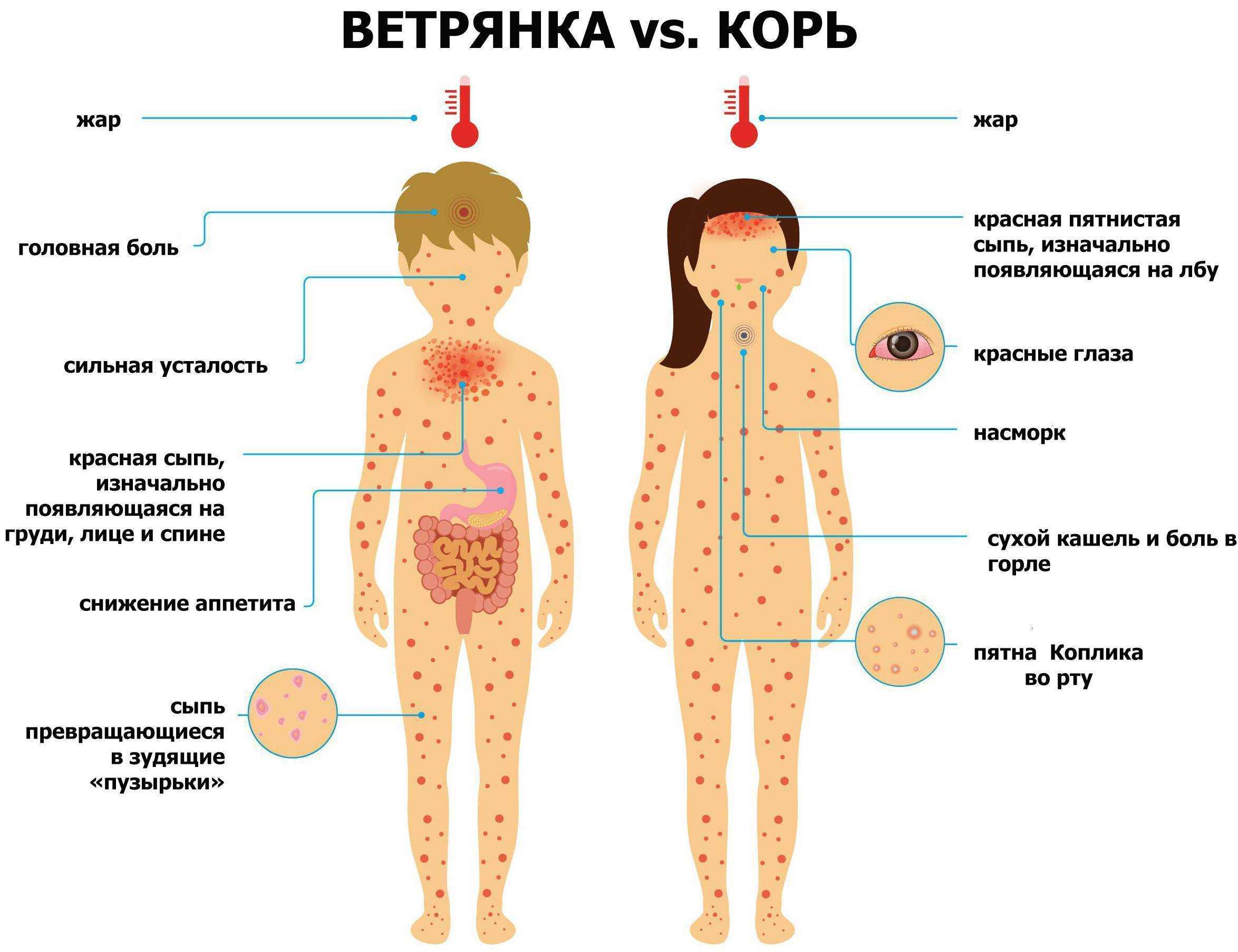Вакцина от ветряной оспы: лучше прививаться, чем болеть! - прививки. вакцинация
