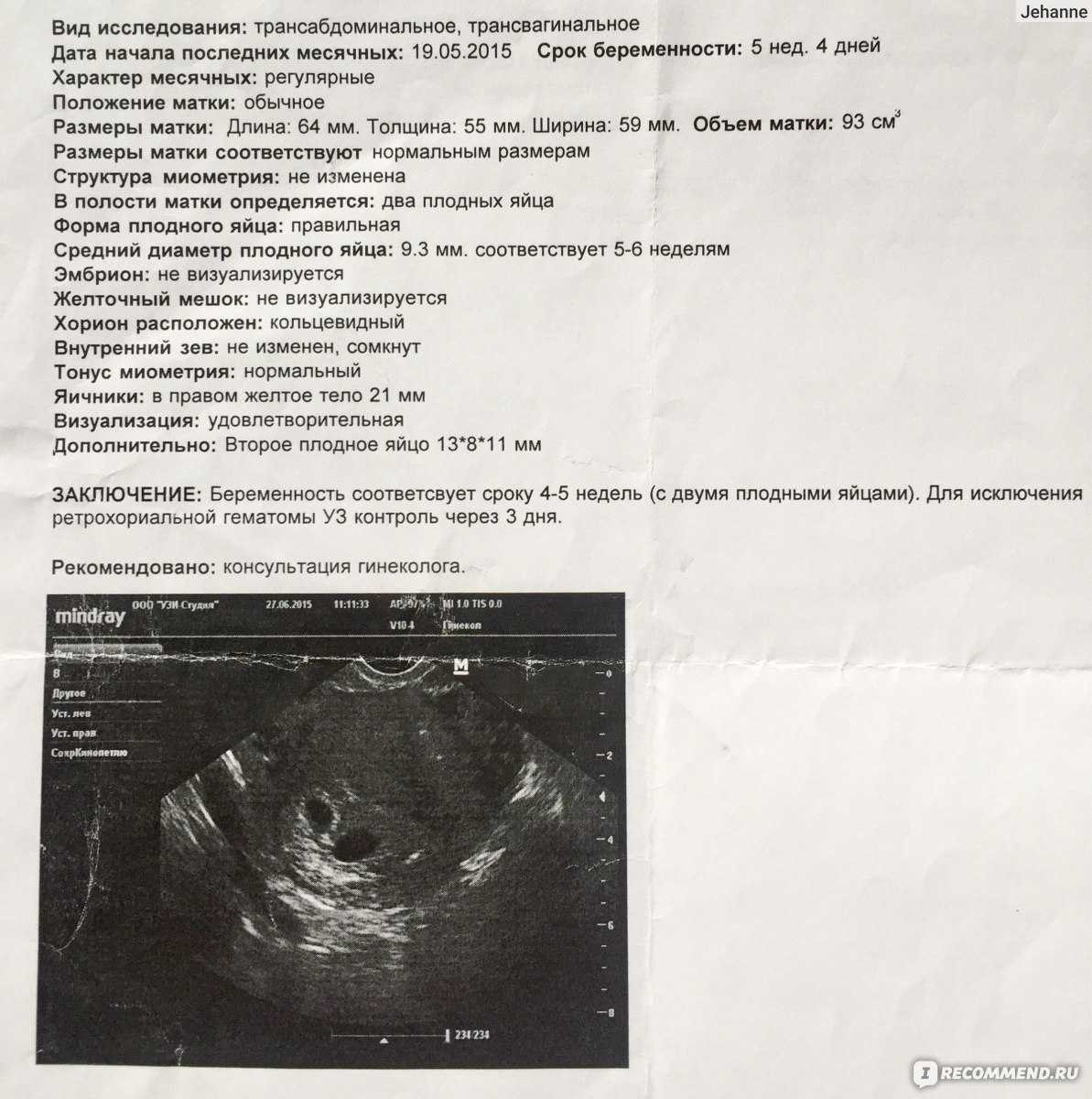 6 неделя беременности: развитие плода, режим будущей мамы