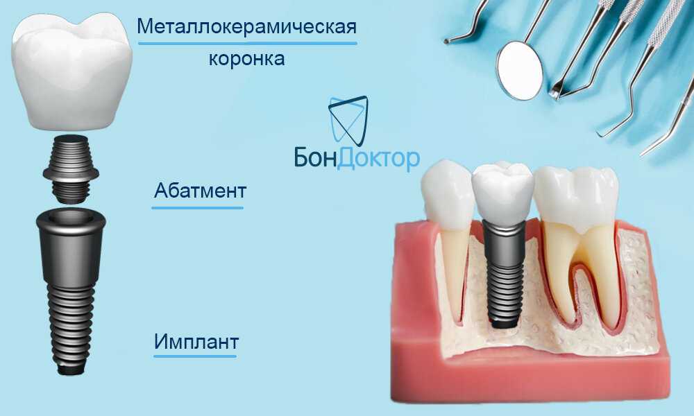 Имплантация эмбриона - симптомы и признаки. как повысить вероятность успешной имплантации эмбриона?