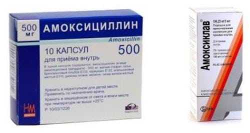 Ревматизм в понимании большинства родителей — заболевание недетское На самом же деле оно часто встречается у школьников после перенесенной ангины