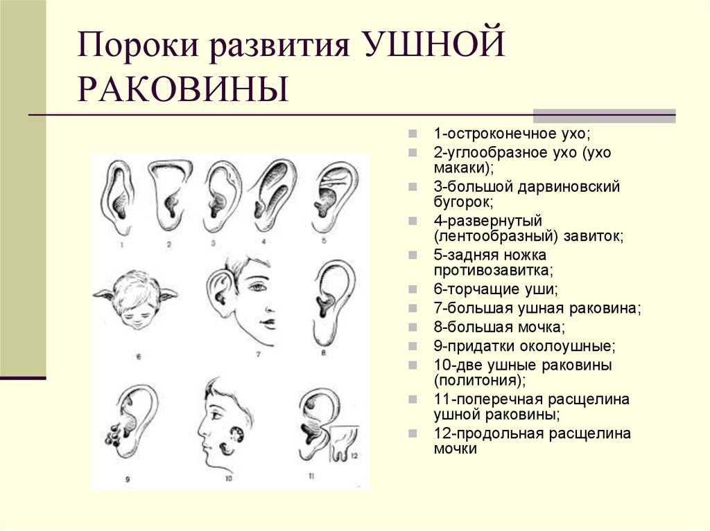 Мочка уха зачем нужна, объяснение генетиков, деформации ушей