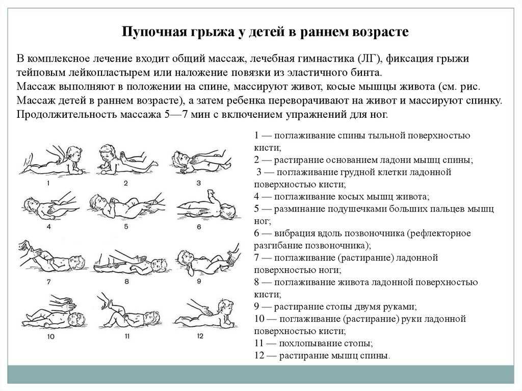 Как заговорить пупочную грыжу у младенца самостоятельно: правила чтения, разновидности ритуалов