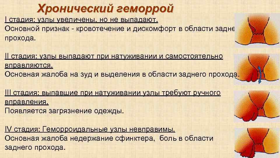 Болит мочеиспускательный канал после родов у женщин - диагностика и лечение