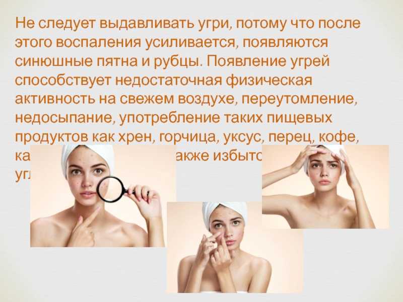 Можно ли давить прыщи. почему нельзя давить некоторые виды прыщей