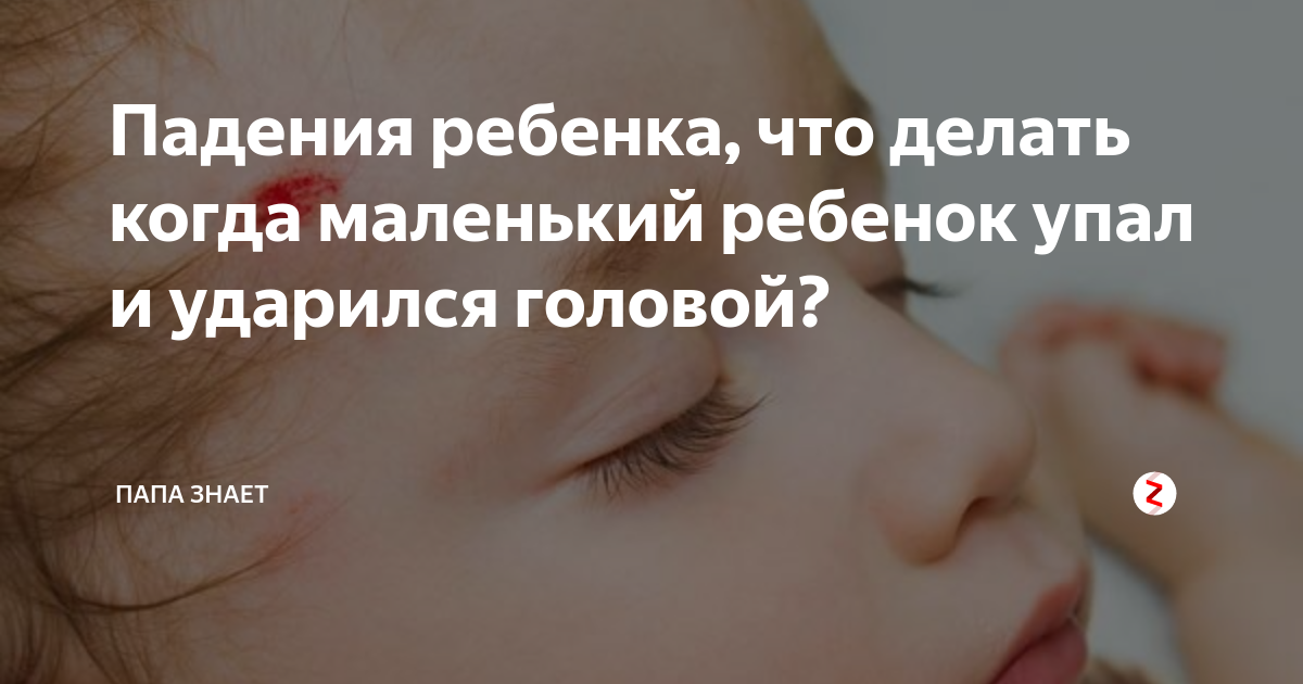 Если ребенок упал