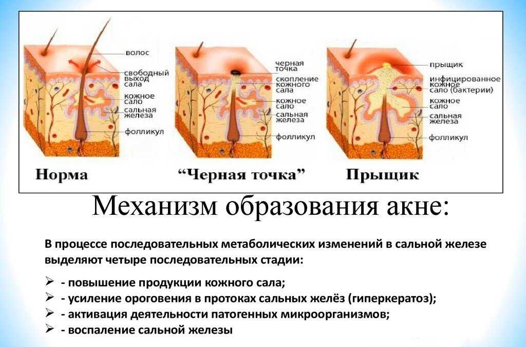 Последствия выдавливания прыщей. как отучиться их давить? можно ли выдавливать прыщи на лице и как от этого отучиться