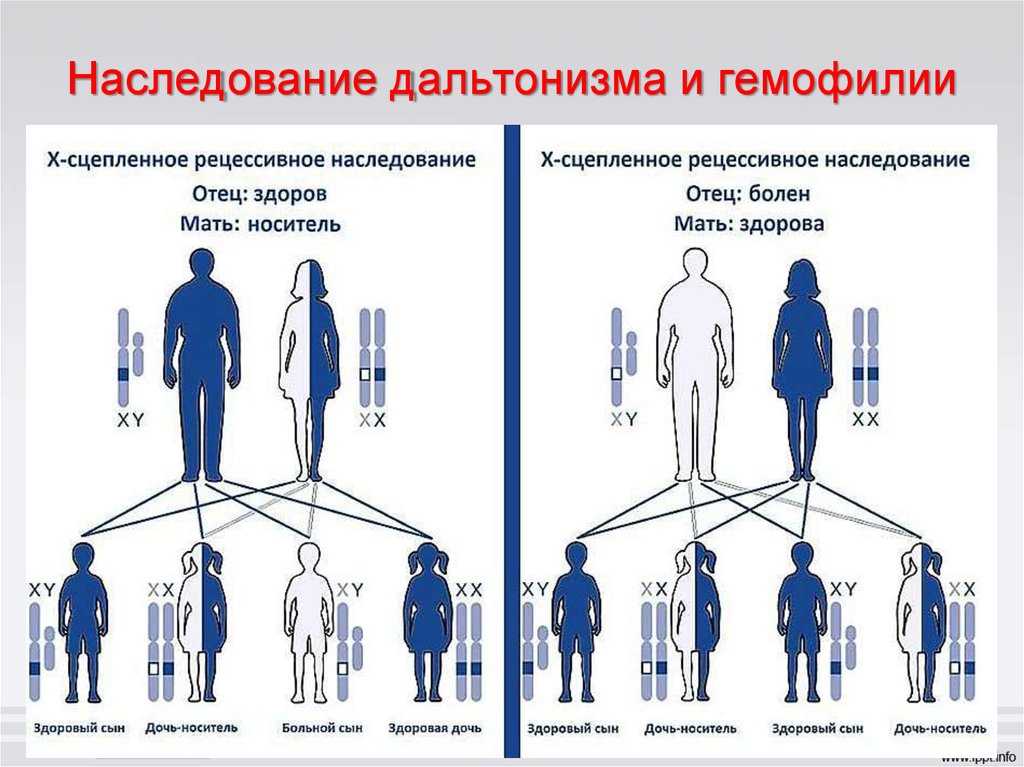 Часто задаваемые вопросы о заикании - (faq) | независимый сайт о заикании