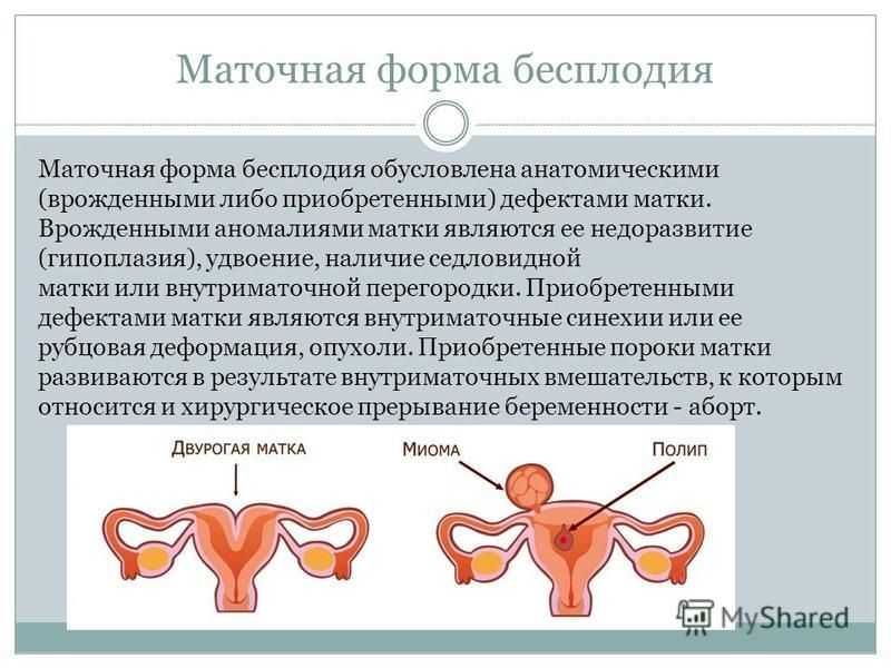 Детская матка у женщины: можно ли забеременеть и родить с такой патологией?