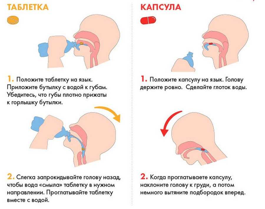 Жевательная резинка создает большие проблемы