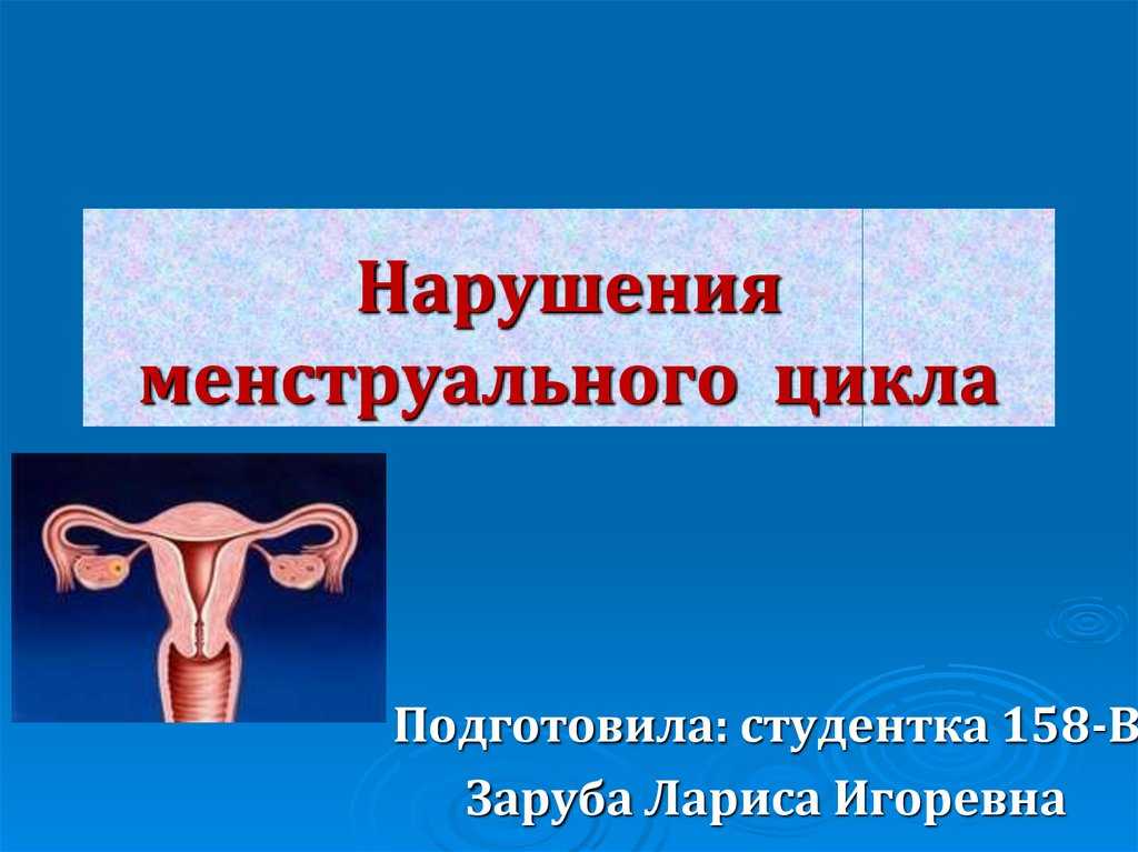 Частые задержки месячных
