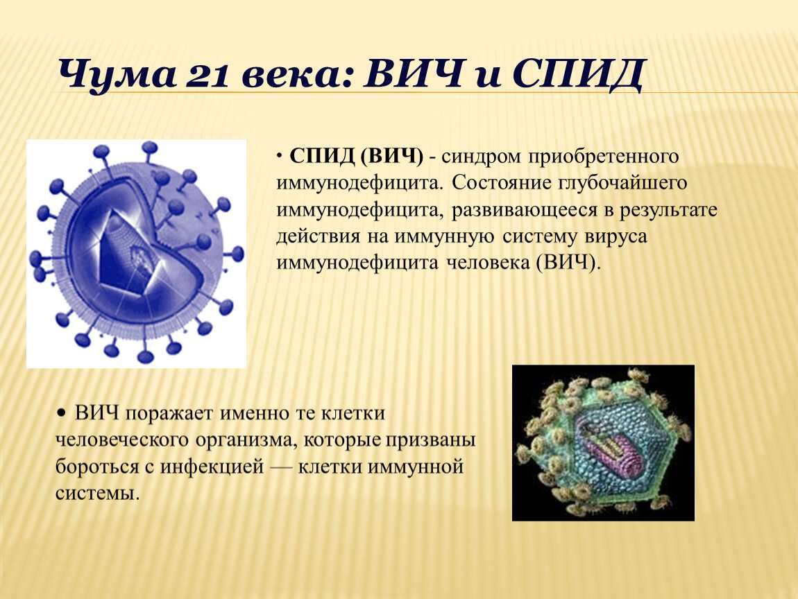 Вич-инфекция: причины, диагностика, лечение