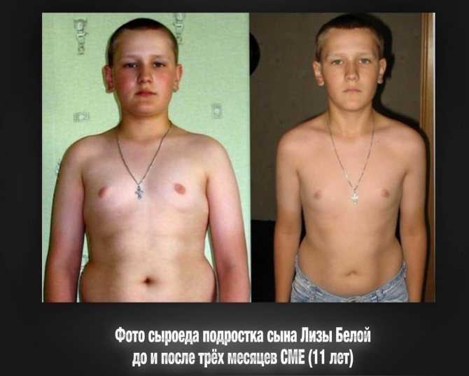 Все про гинекомастию у мужчин – симптомы, причины, лечение, операция и стоимость * клиника диана в санкт-петербурге