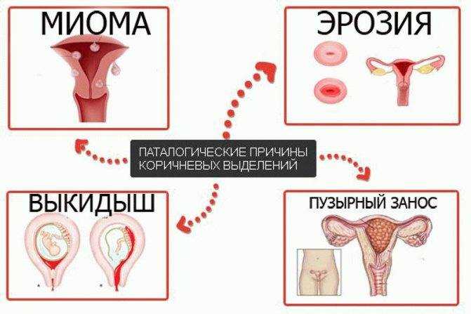 Повышенный аппетит перед месячными: диета и зверский голод