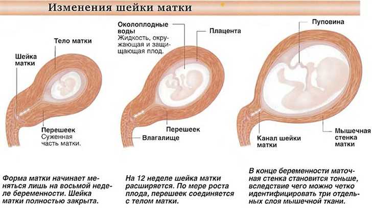 Шейка матки: созревание и раскрытие