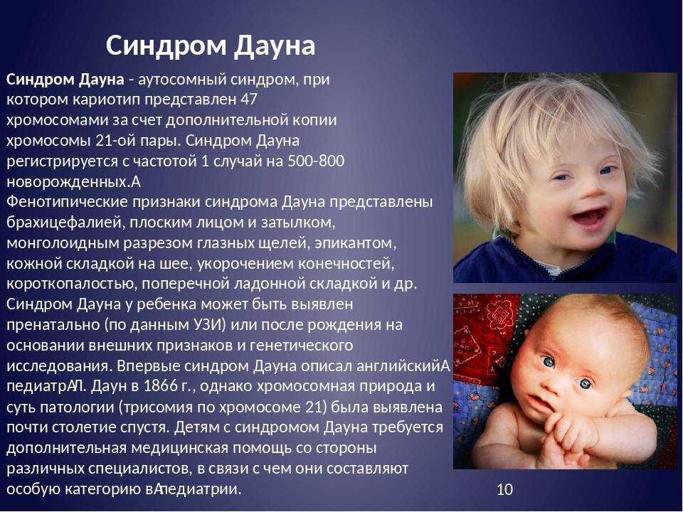 Международный день человека с синдромом дауна в 2024 году: какого числа отмечают, дата и история праздника
