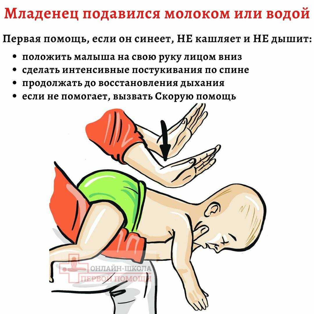Что делать, если ребенок подавился?