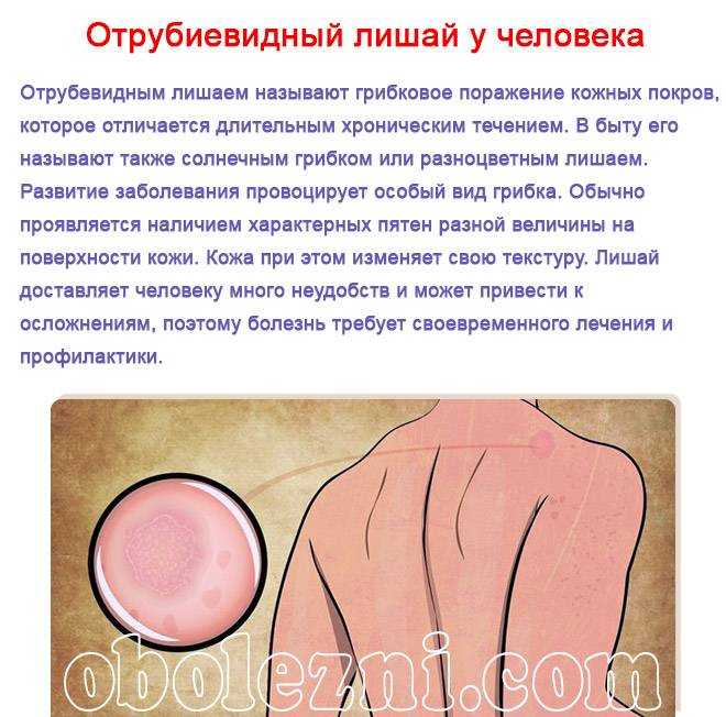 Состав болтушки при солнечном лишае