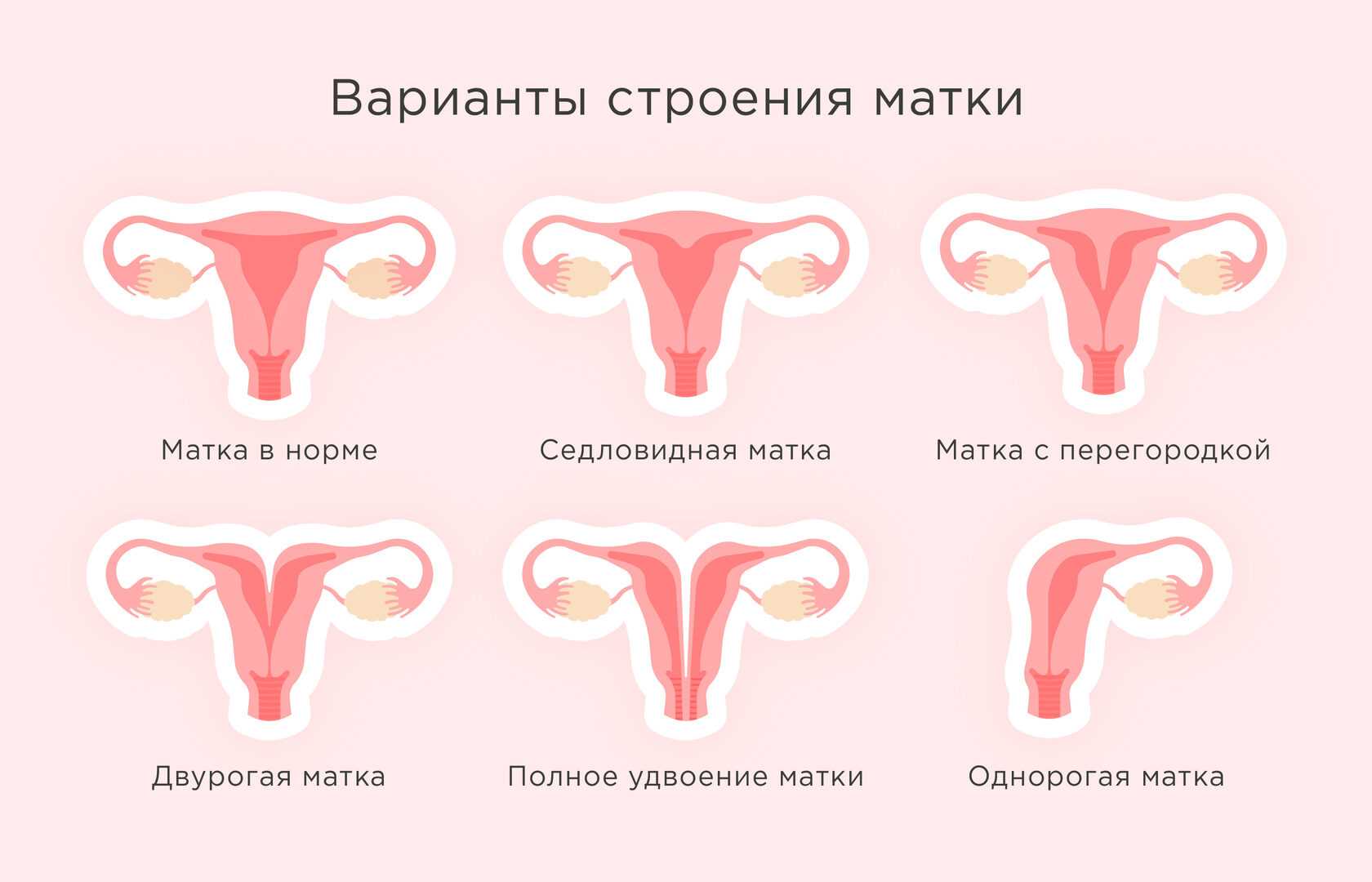 Седловидная матка и беременность: 14 отзывов и историй, удивительные факты