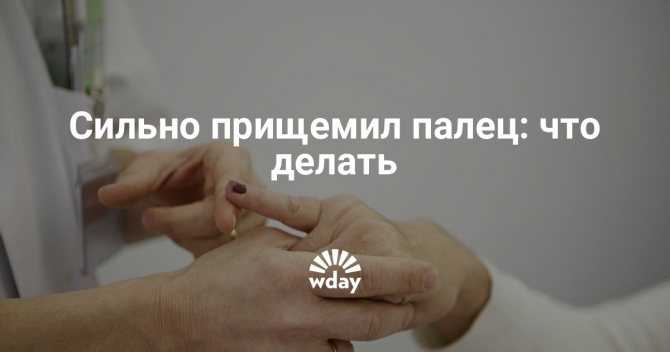 Прищемила палец дверью - первая помощь взрослому и ребенку