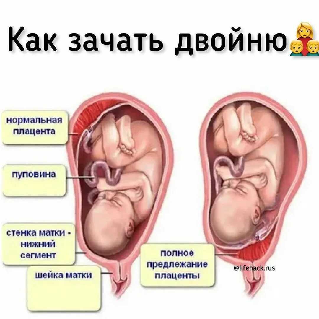 10 важных советов для тех мам, которые ждут двойню