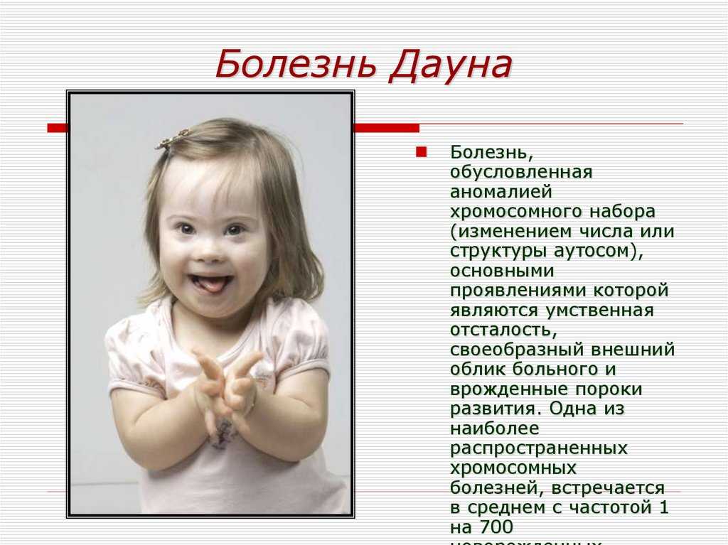 Распространенные мифы о синдроме дауна и 4 человека, которые красиво их разрушили