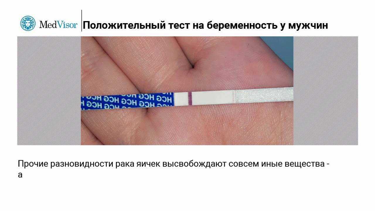 Ложноположительный тест на беременность: причины и что нужно делать