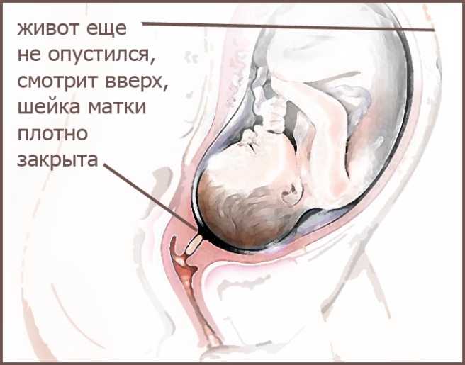 Больно ли прокалывать пузырь с водами перед родами?