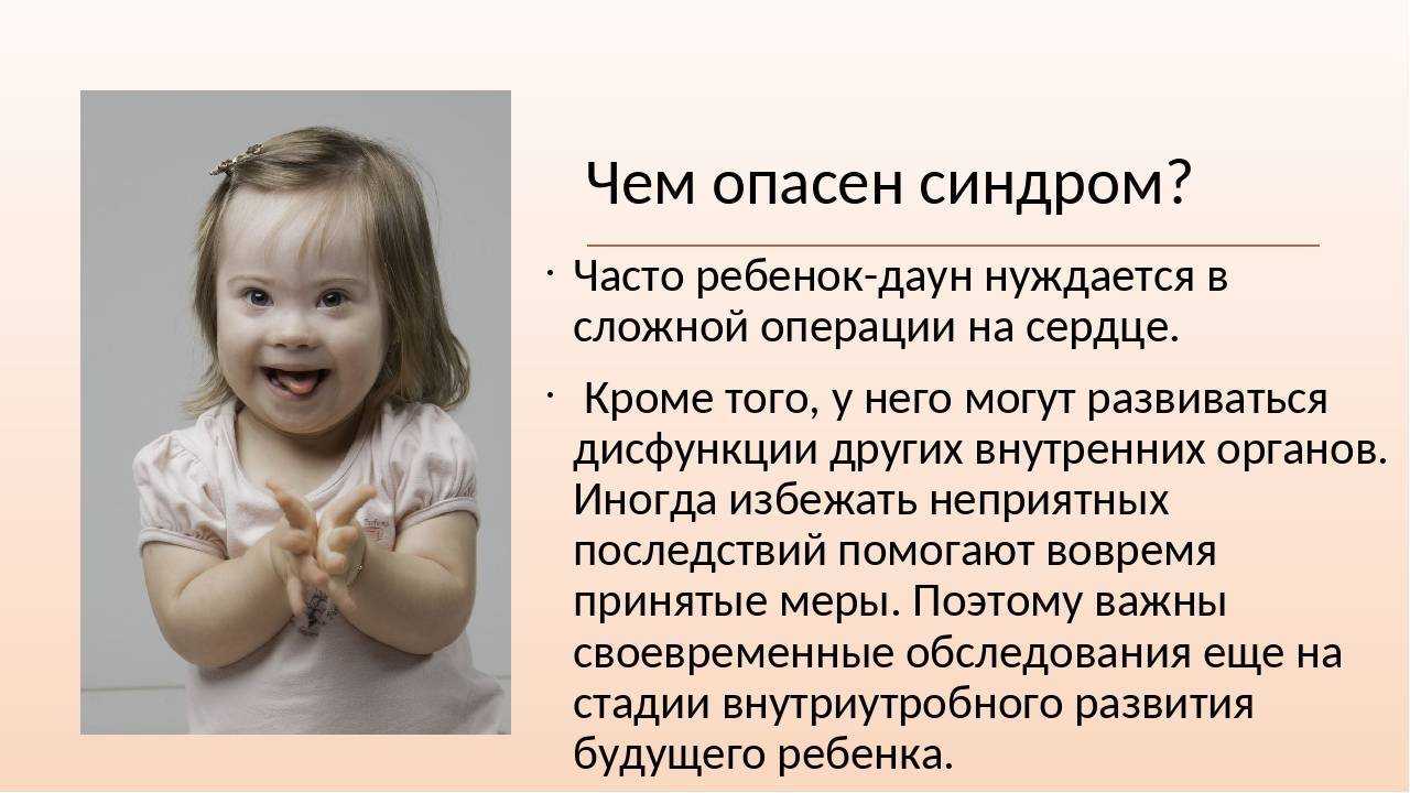 Дети солнца: 5 заблуждений о людях с синдромом дауна | thegirl