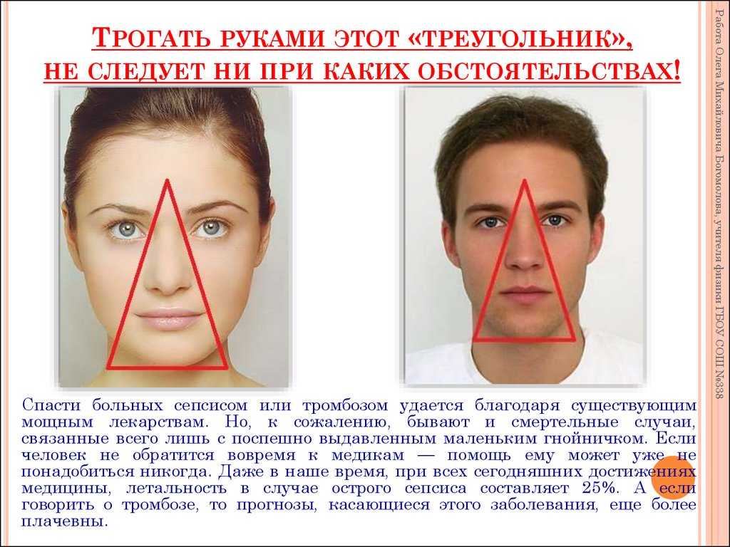 Почему прыщ не должен лопаться?