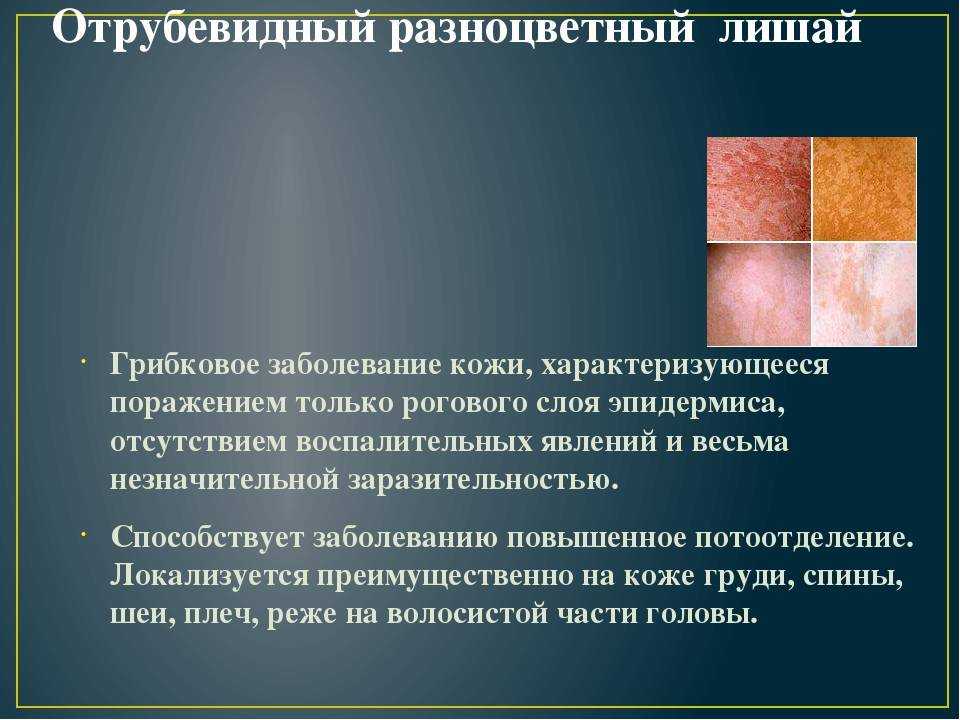 Загорайте осторожно! — мир здоровья — многопрофильный медицинский центр