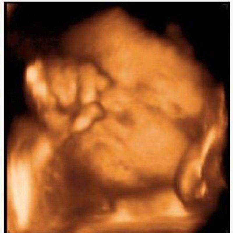 33 неделя беременности